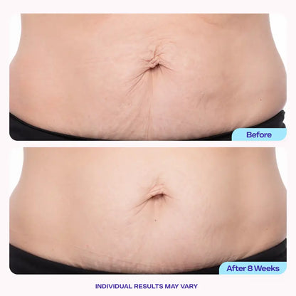Belly Firming Cream for Tightening & Smoothing Skin